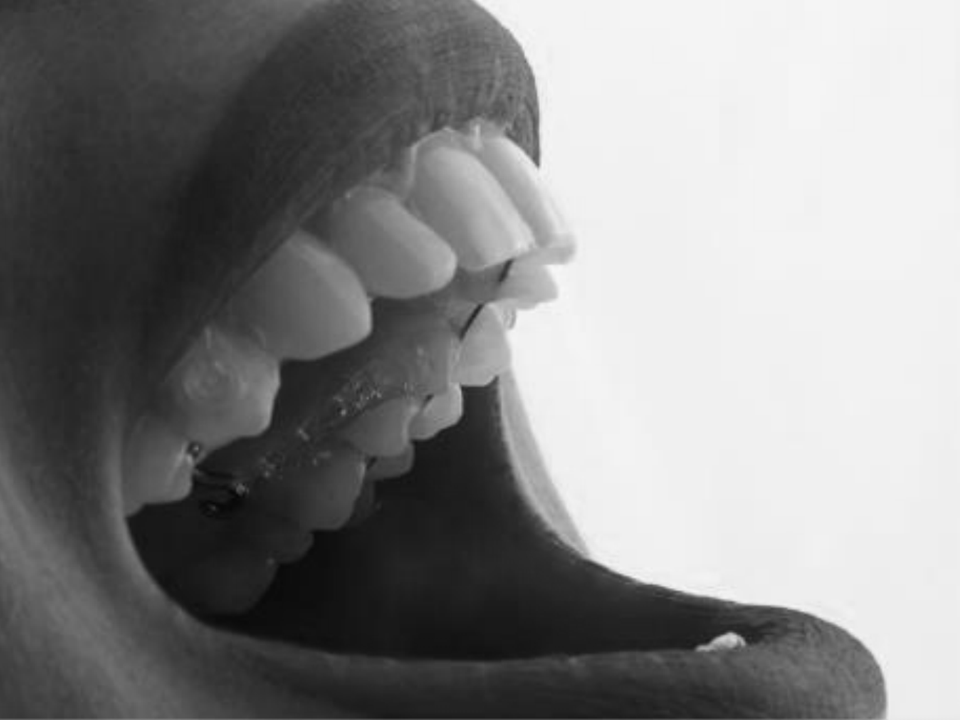 ortodontialingual-2-960×720
